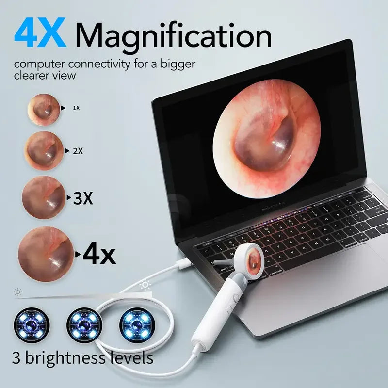 Portable 1080p HD Ear Scope Camera with 1.38" IPS Screen, 90° Rotatable Lens and 12 Observation Covers