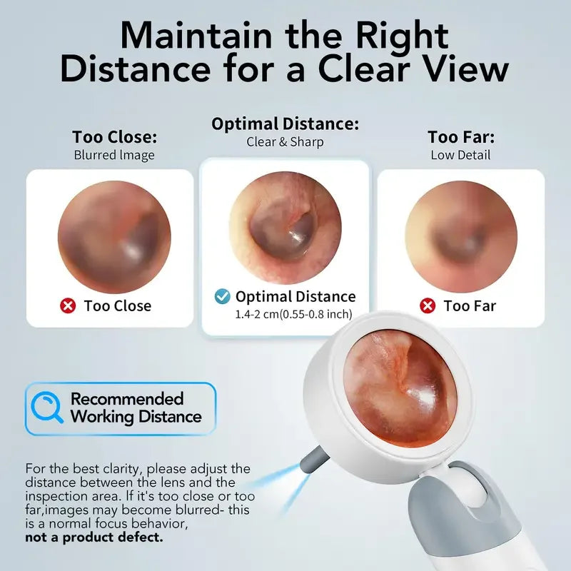 Portable 1080p HD Ear Scope Camera with 1.38" IPS Screen, 90° Rotatable Lens and 12 Observation Covers